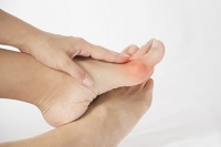 Bunions Are Common