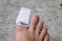 An Effective Treatment Method For Broken Toes